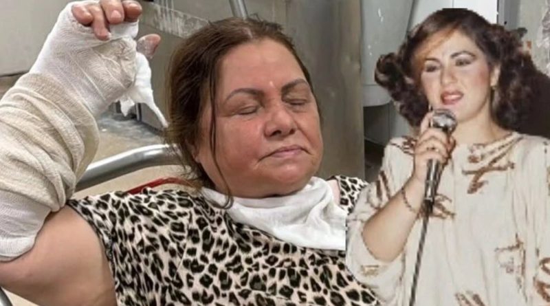 TÜDANYA DÜŞEREK KOLUNU KIRDI